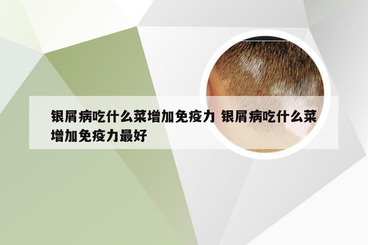 银屑病吃什么菜增加免疫力 银屑病吃什么菜增加免疫力最好
