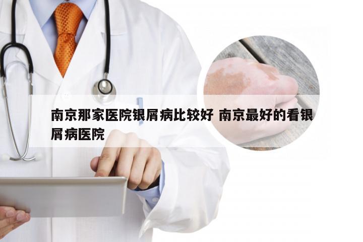 南京那家医院银屑病比较好 南京最好的看银屑病医院