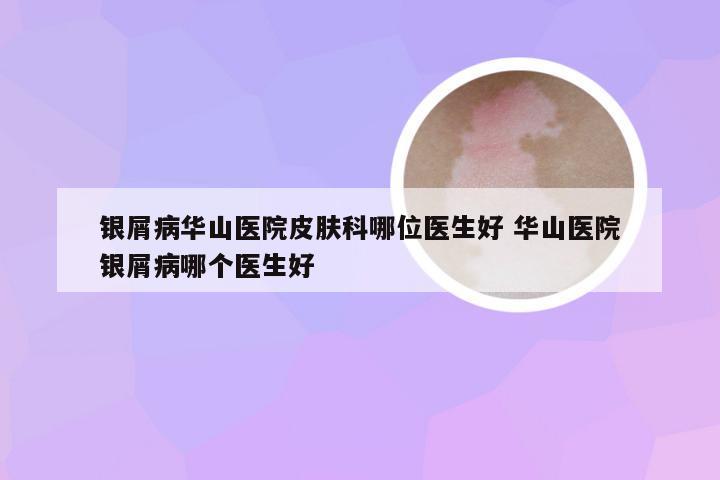 银屑病华山医院皮肤科哪位医生好 华山医院银屑病哪个医生好