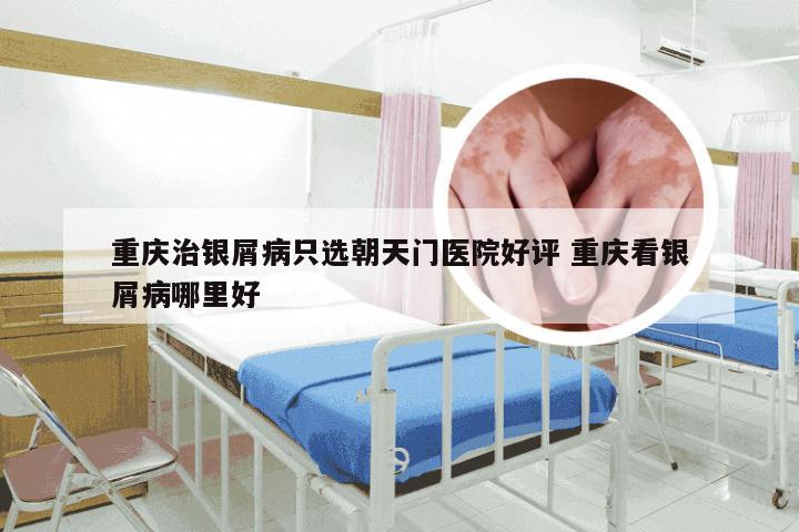 重庆治银屑病只选朝天门医院好评 重庆看银屑病哪里好