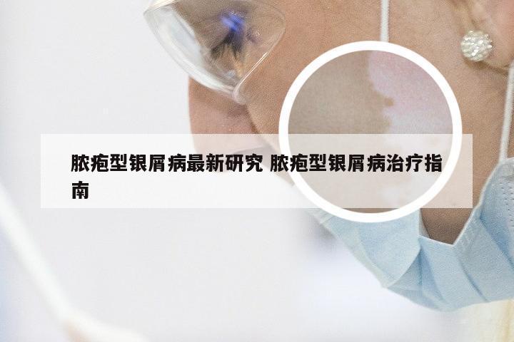 脓疱型银屑病最新研究 脓疱型银屑病治疗指南