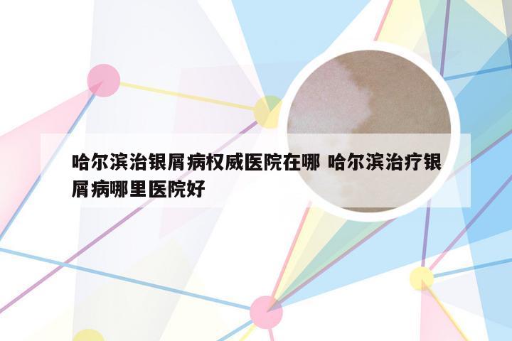 哈尔滨治银屑病权威医院在哪 哈尔滨治疗银屑病哪里医院好