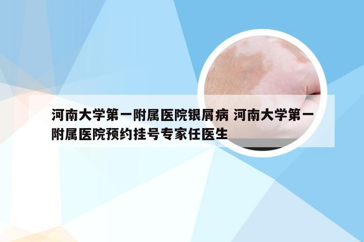 河南大学第一附属医院银屑病 河南大学第一附属医院预约挂号专家任医生