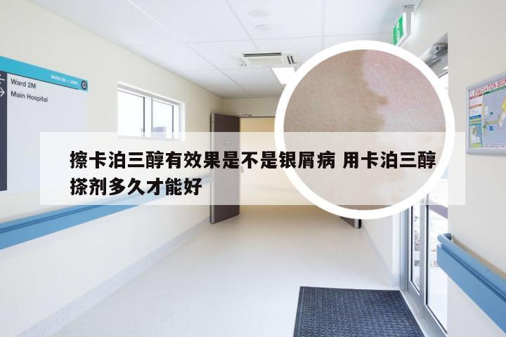 擦卡泊三醇有效果是不是银屑病 用卡泊三醇搽剂多久才能好