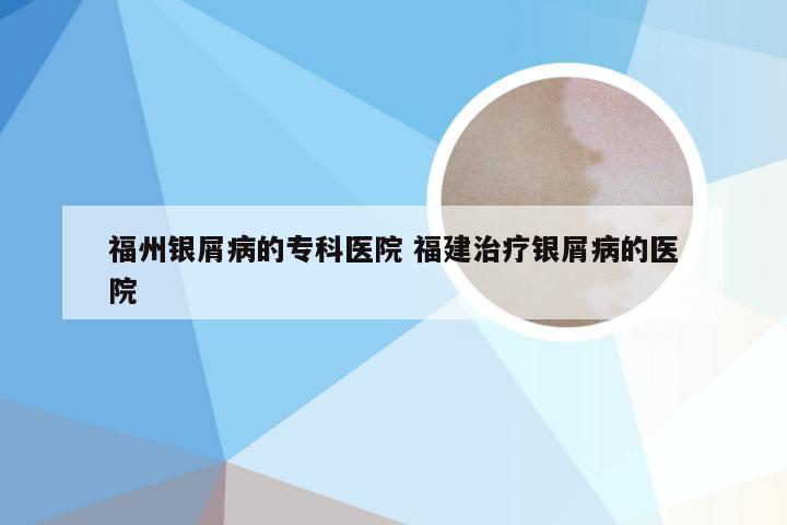 福州银屑病的专科医院 福建治疗银屑病的医院