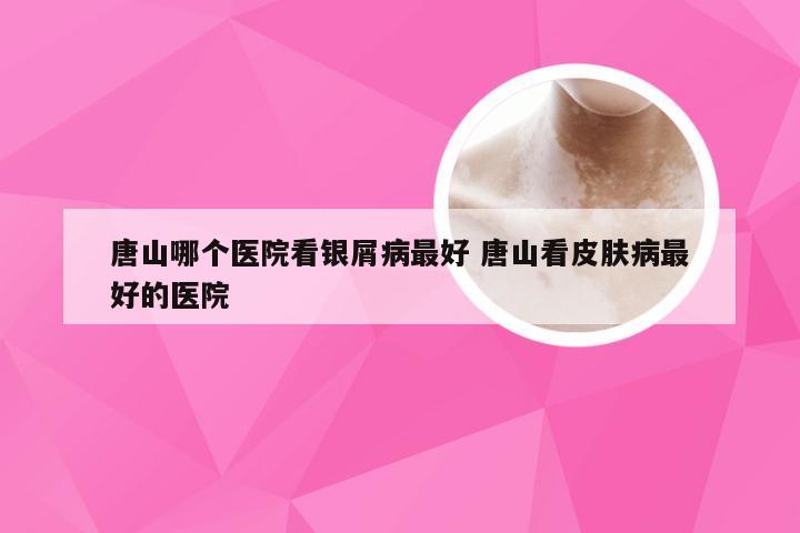 唐山哪个医院看银屑病最好 唐山看皮肤病最好的医院