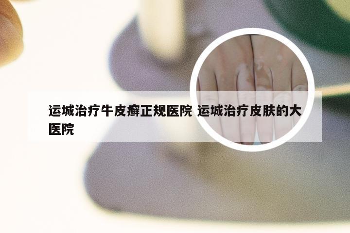 运城治疗牛皮癣正规医院 运城治疗皮肤的大医院