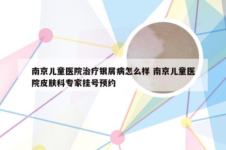 南京儿童医院治疗银屑病怎么样 南京儿童医院皮肤科专家挂号预约