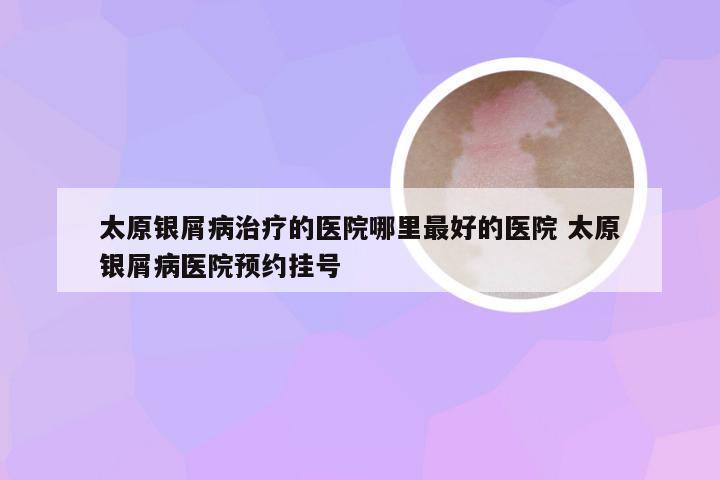 太原银屑病治疗的医院哪里最好的医院 太原银屑病医院预约挂号