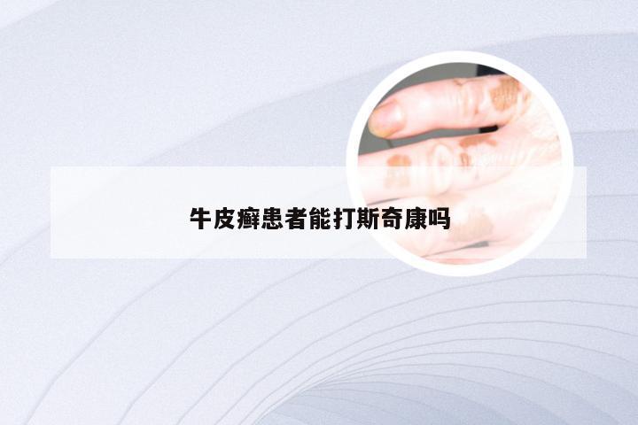 牛皮癣患者能打斯奇康吗