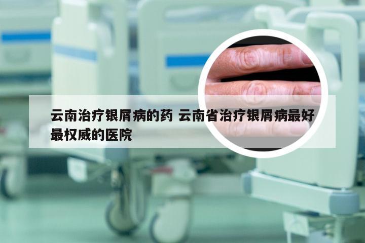 云南治疗银屑病的药 云南省治疗银屑病最好最权威的医院