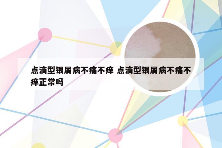 点滴型银屑病不痛不痒 点滴型银屑病不痛不痒正常吗