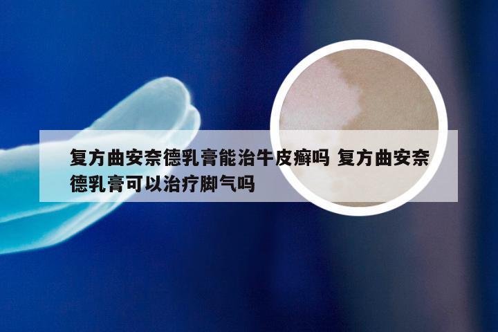 复方曲安奈德乳膏能治牛皮癣吗 复方曲安奈德乳膏可以治疗脚气吗