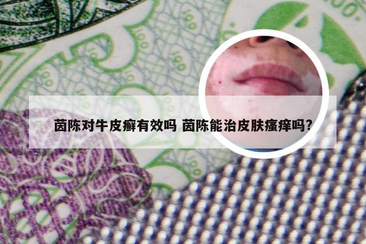 茵陈对牛皮癣有效吗 茵陈能治皮肤瘙痒吗?