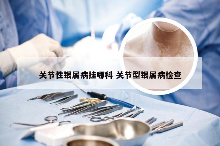 关节性银屑病挂哪科 关节型银屑病检查