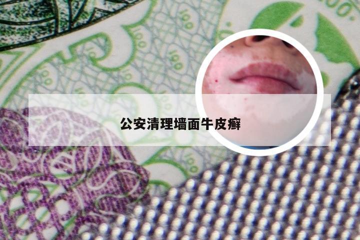 公安清理墙面牛皮癣
