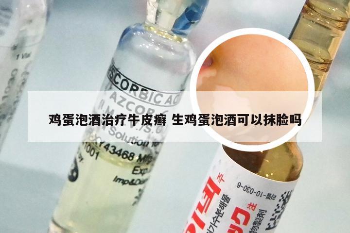 鸡蛋泡酒治疗牛皮癣 生鸡蛋泡酒可以抹脸吗