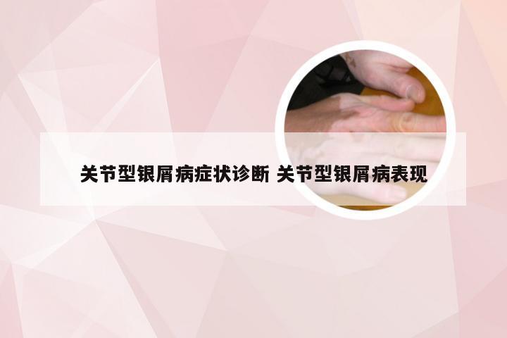 关节型银屑病症状诊断 关节型银屑病表现