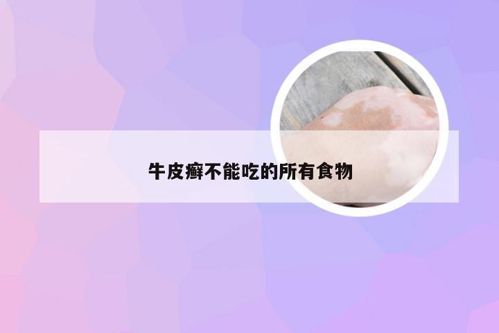 牛皮癣不能吃的所有食物