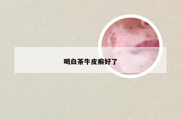 喝白茶牛皮癣好了