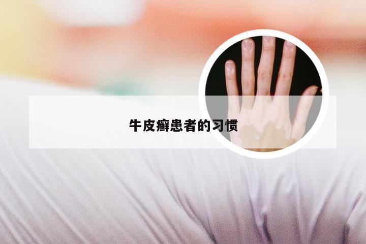 牛皮癣患者的习惯