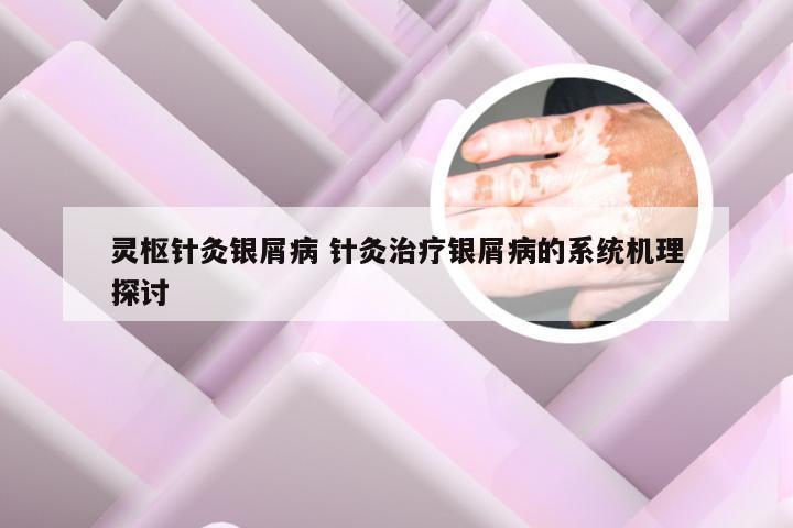 灵枢针灸银屑病 针灸治疗银屑病的系统机理探讨