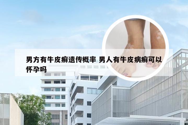 男方有牛皮癣遗传概率 男人有牛皮病癣可以怀孕吗