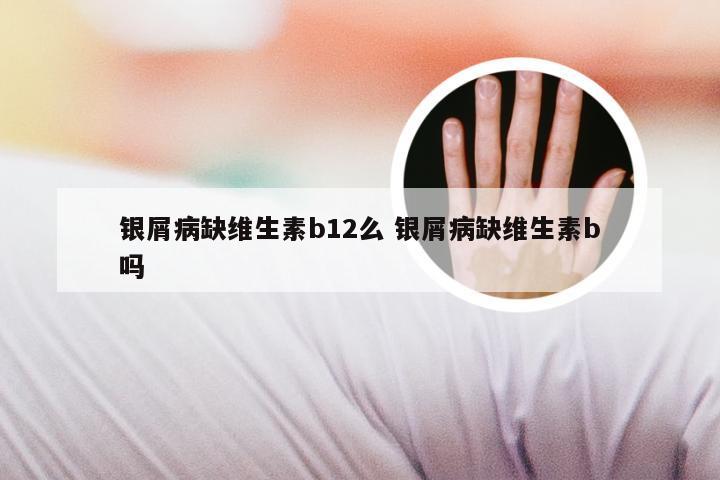 银屑病缺维生素b12么 银屑病缺维生素b吗