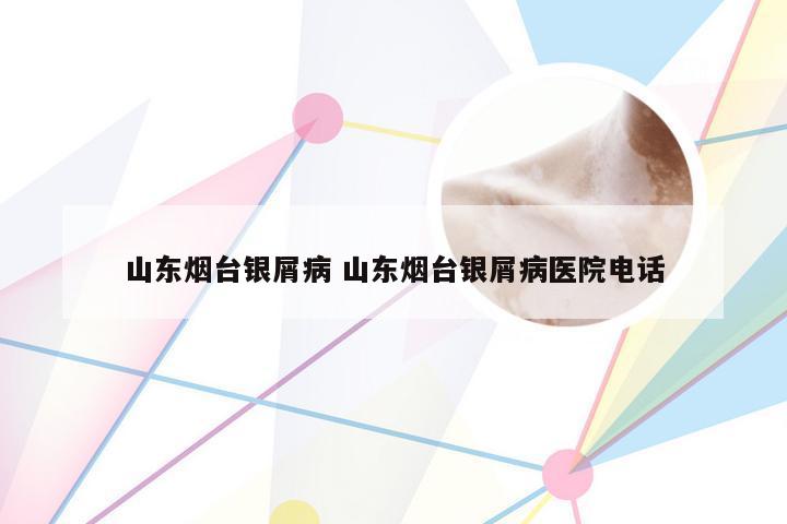 山东烟台银屑病 山东烟台银屑病医院电话
