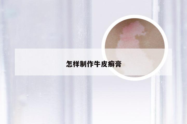 怎样制作牛皮癣膏