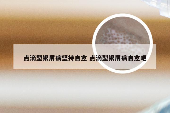 点滴型银屑病坚持自愈 点滴型银屑病自愈吧