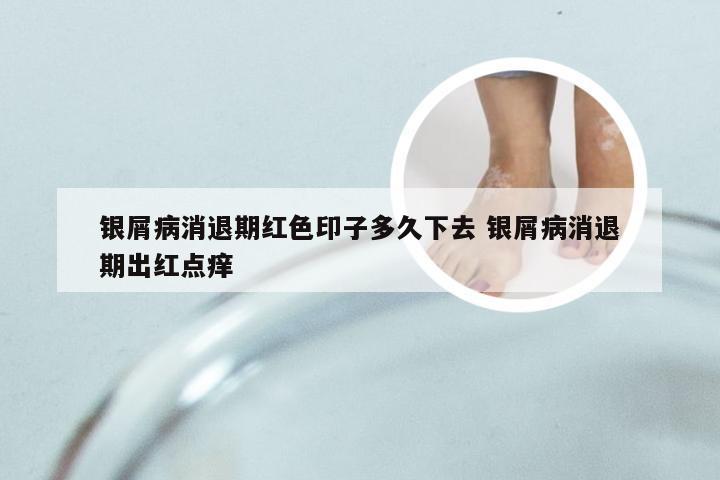 银屑病消退期红色印子多久下去 银屑病消退期出红点痒