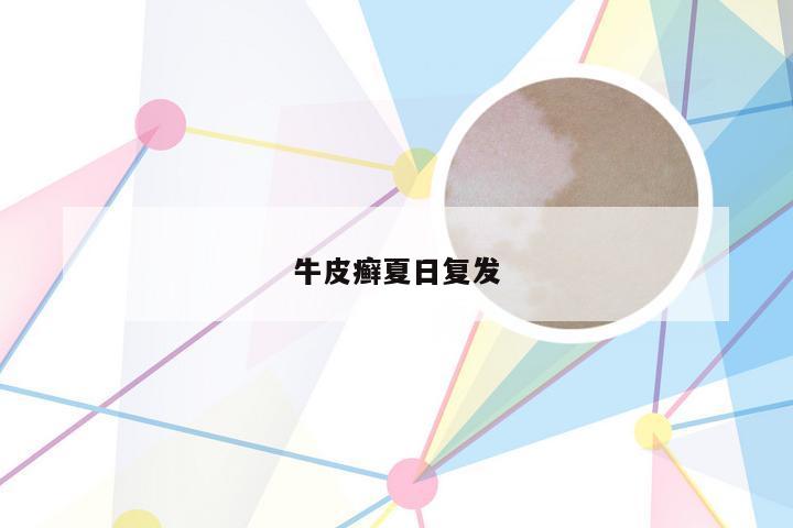 牛皮癣夏日复发