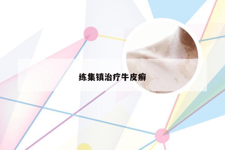 练集镇治疗牛皮癣