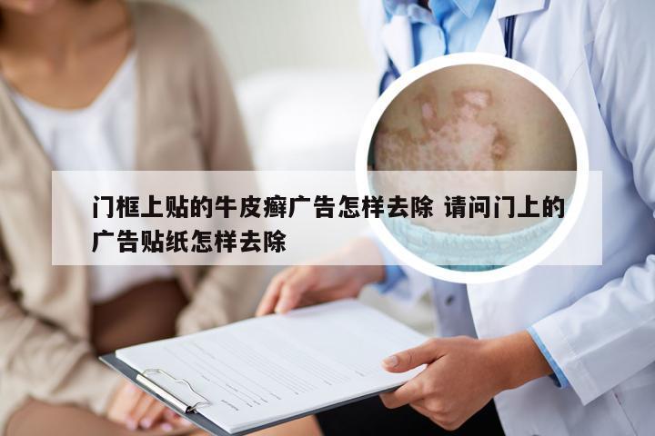 门框上贴的牛皮癣广告怎样去除 请问门上的广告贴纸怎样去除