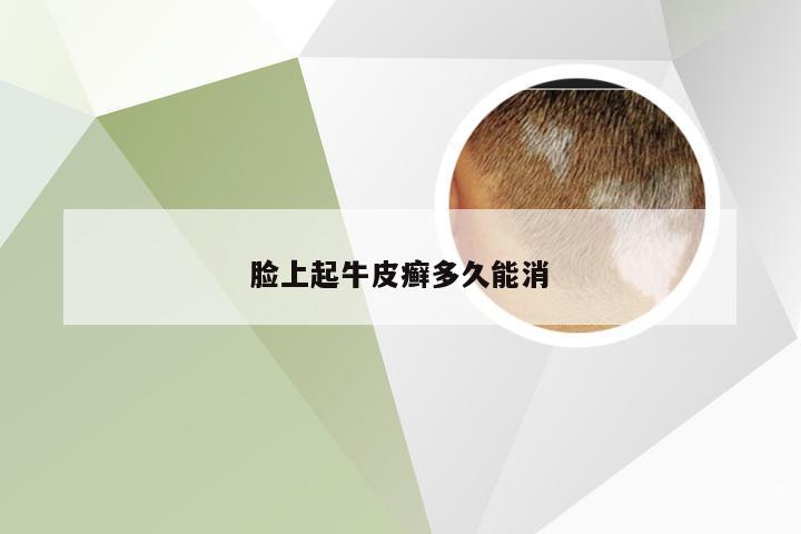 脸上起牛皮癣多久能消