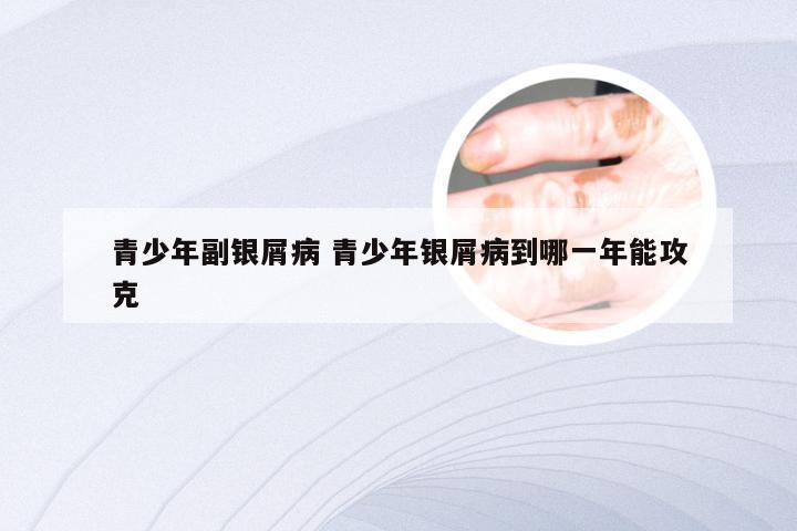 青少年副银屑病 青少年银屑病到哪一年能攻克
