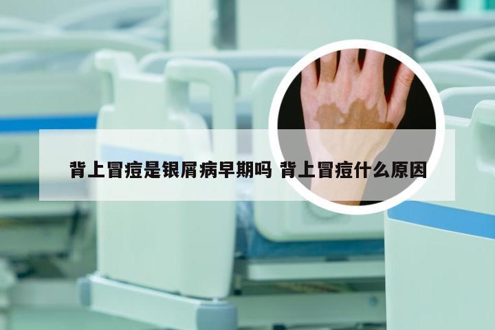 背上冒痘是银屑病早期吗 背上冒痘什么原因