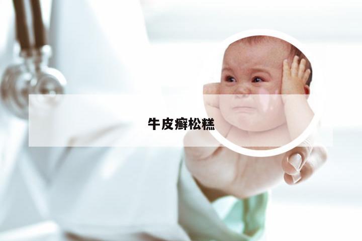 牛皮癣松糕