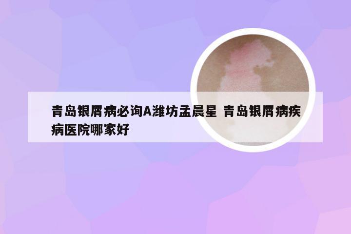 青岛银屑病必询A潍坊孟晨星 青岛银屑病疾病医院哪家好