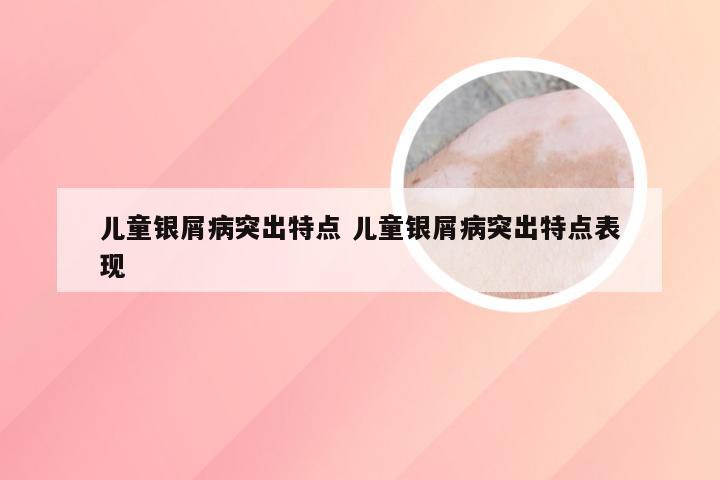 儿童银屑病突出特点 儿童银屑病突出特点表现