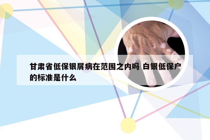 甘肃省低保银屑病在范围之内吗 白银低保户的标准是什么