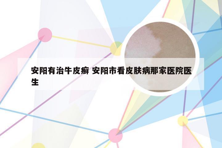 安阳有治牛皮癣 安阳市看皮肤病那家医院医生
