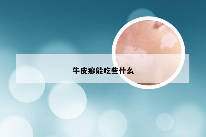 牛皮癣能吃些什么