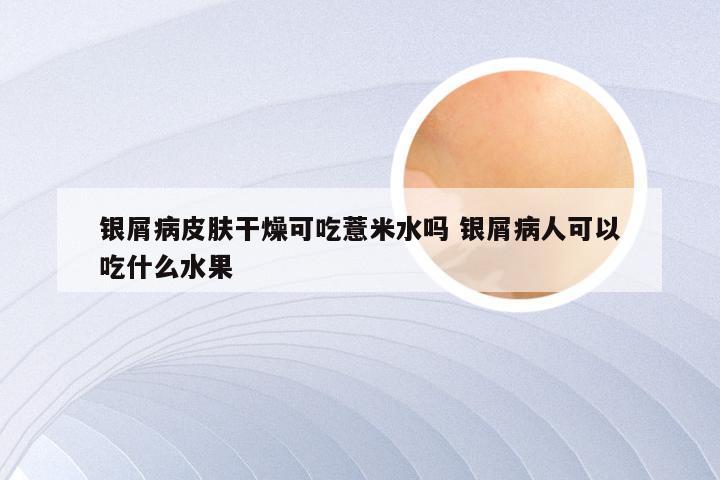 银屑病皮肤干燥可吃薏米水吗 银屑病人可以吃什么水果