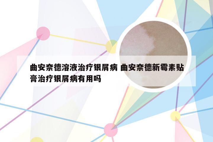 曲安奈德溶液治疗银屑病 曲安奈德新霉素贴膏治疗银屑病有用吗