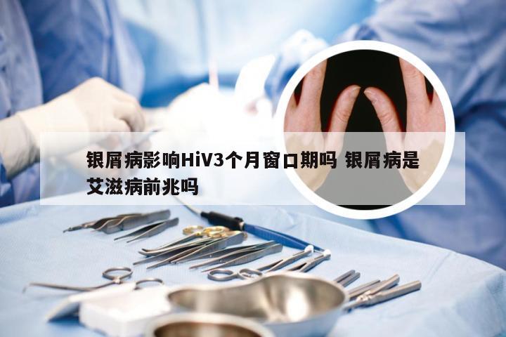 银屑病影响HiV3个月窗口期吗 银屑病是艾滋病前兆吗