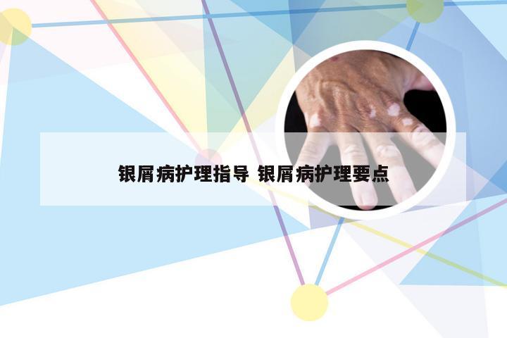 银屑病护理指导 银屑病护理要点