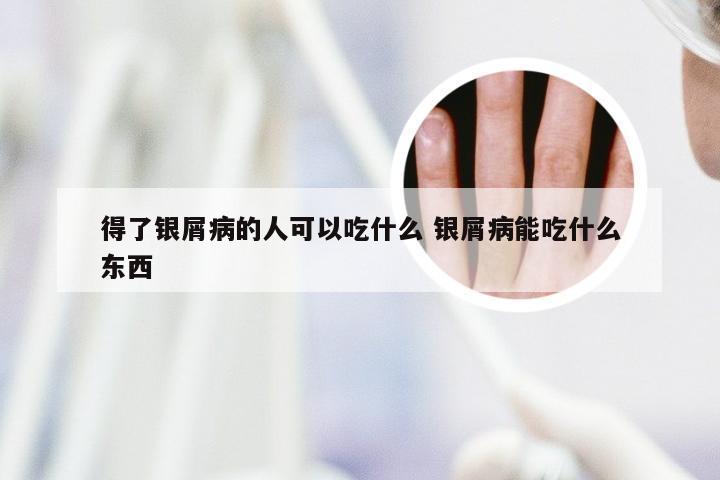 得了银屑病的人可以吃什么 银屑病能吃什么东西