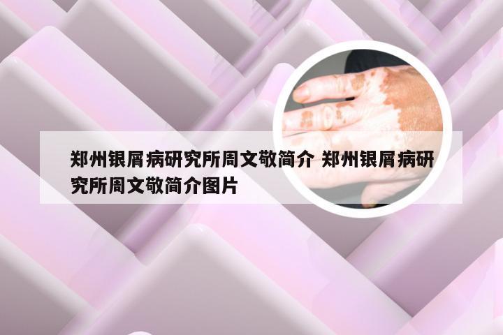 郑州银屑病研究所周文敬简介 郑州银屑病研究所周文敬简介图片